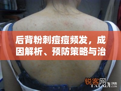 后背粉刺痘痘频发，成因解析、预防策略与治疗方法