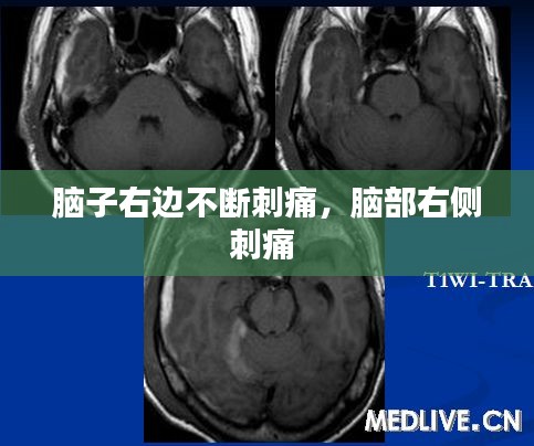 脑子右边不断刺痛，脑部右侧刺痛 