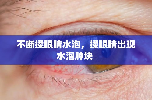 不断揉眼睛水泡，揉眼睛出现水泡肿块 