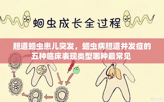 胆道蛔虫患儿突发，蛔虫病胆道并发症的五种临床表现类型哪种最常见 
