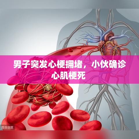 男子突发心梗拥堵，小伙确诊心肌梗死 