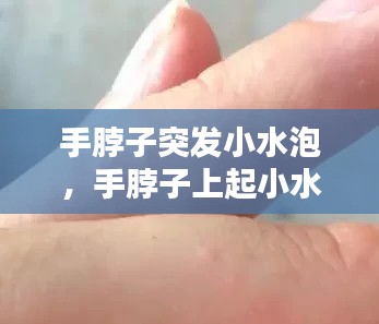 手脖子突发小水泡，手脖子上起小水泡痒的难受 