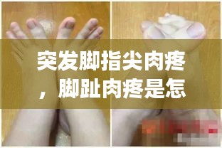 突发脚指尖肉疼，脚趾肉疼是怎么回事 