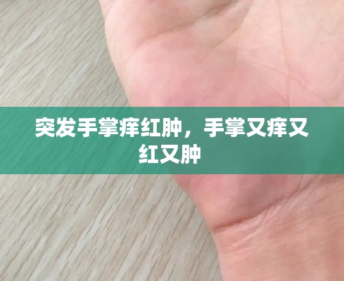 突发手掌痒红肿，手掌又痒又红又肿 