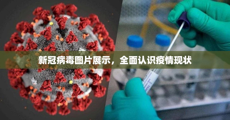 新冠病毒图片展示，全面认识疫情现状