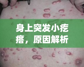 身上突发小疙瘩，原因解析、处理方法及预防策略