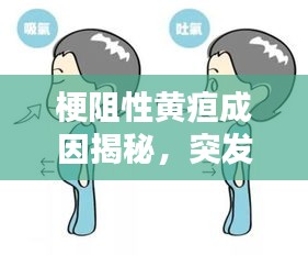 梗阻性黄疸成因揭秘，突发状况如何应对？应对策略全解析