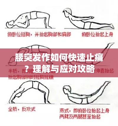 腰突发作如何快速止痛？理解与应对攻略