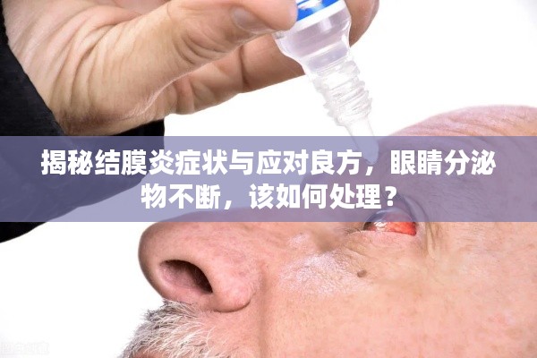 揭秘结膜炎症状与应对良方，眼睛分泌物不断，该如何处理？