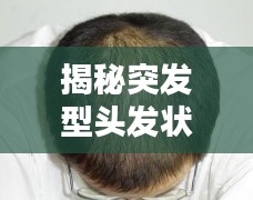 揭秘突发型头发状况，原因解析、应对方法与日常护理全攻略