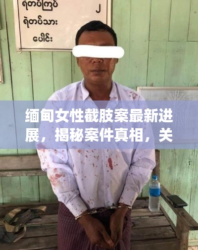 缅甸女性截肢案最新进展，揭秘案件真相，关注受害者权益保护