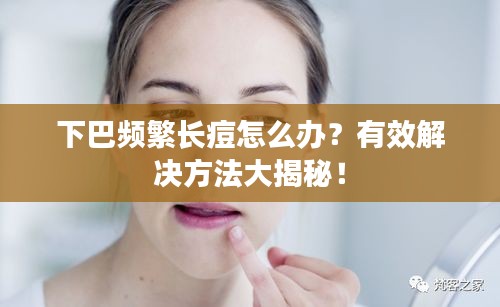 下巴频繁长痘怎么办？有效解决方法大揭秘！
